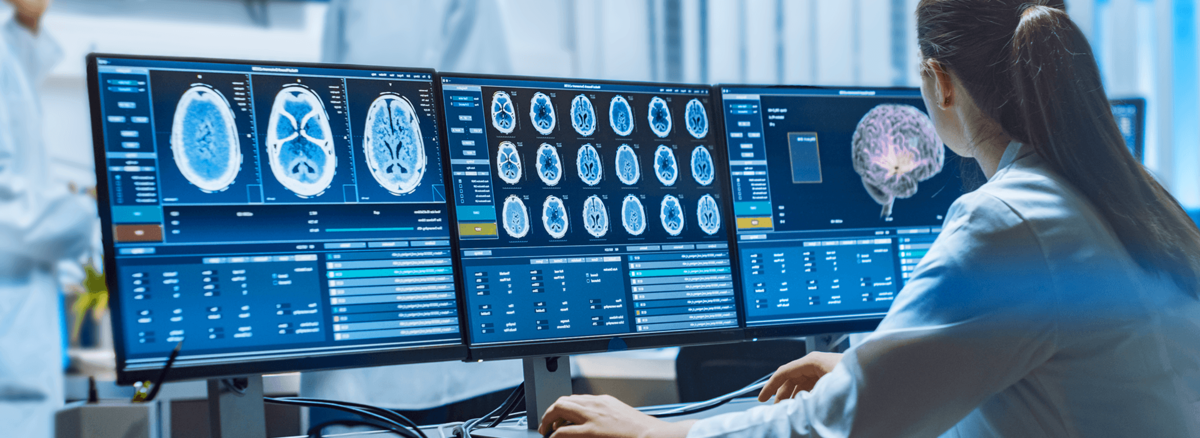 Teaserbild KI-gestütze Diagnoseverfahren